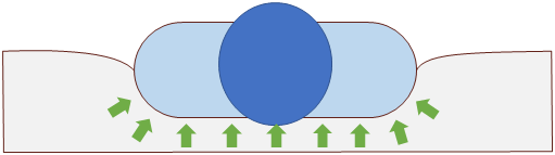 Envelopment as a part of treatment of pressure ulcers.